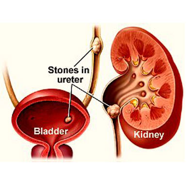 Unwanted Hair Growth